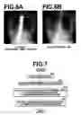 Fig. 05 - Chest image rotation apparatus, method and recording-medium stored therein program