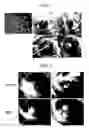 Fig. 02 - Pharmaceutical Composition For Treating Vascular-Related Diseases Comprising Peptide