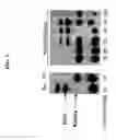 Fig. 06 - Method of preparing non-human tissues for xenotransplantation using α-galactosidase