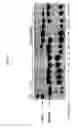 Fig. 07 - Method of preparing non-human tissues for xenotransplantation using α-galactosidase