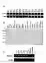 Fig. 02 - Genes and polypeptides relating to prostate cancers