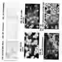 Fig. 02 - Defective ribosomal products in blebs (DRibbles) and methods of use to stimulate an immune response