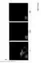 Fig. 07 - VACCINE DELIVERY SYSTEM