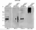 Fig. 01 - Recombinant mononegaviral virus vectors