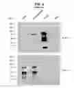 Fig. 07 - Recombinant mononegaviral virus vectors