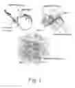 Fig. 02 - Prevascularized constructs for implantation to provide blood perfusion