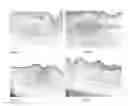 Fig. 08 - Herbal acne control composition, method of manufacturing the same and use thereof