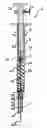 Fig. 01 - OCCLUSION DEVICE FOR BLOCKING AN APICAL OPENING OF A ROOT CANAL OF A TOOTH