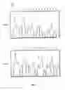 Fig. 02 - Systemic Carnitine Deficiency Gene and Uses Thereof