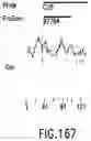 Fig. 352 - Novel genes encoding proteins having prognostic, diagnostic, preventive, therapeutic, and other uses