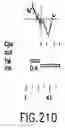 Fig. 445 - Novel genes encoding proteins having prognostic, diagnostic, preventive, therapeutic, and other uses