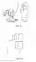 Fig. 02 - Electrosurgical method and system for treating foot ulcer