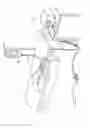 Fig. 03 - Electrosurgical method and system for treating foot ulcer