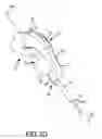 Fig. 09 - Hip resurfacing surgical guide tool