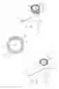 Fig. 09 - Instrument for Introducing Solid Fillers into the Interior of a Bone