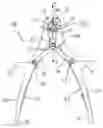 Fig. 01 - Surgical bending forceps and bending forceps system