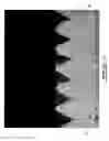 Fig. 08 - Porous material and method for fabricating same