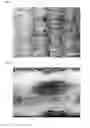 Fig. 02 - Cleansing polyester fabrics, and a process of preparing the same