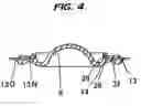 Fig. 04 - Liquid Filled Type Vibration Isolator