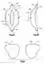 Fig. 06 - Bi-lobular air bag