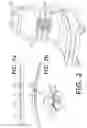 Fig. 03 - Manipulable lumbar support utilizing active material actuation