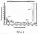 Fig. 04 - Peak visualization enhancement display system for use with a compressed waveform display on a non-destructive inspection instrument