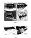 Fig. 07 - APPARATUS FOR PROVIDING ENDOSCOPIC HIGH-SPEED OPTICAL COHERENCE TOMOGRAPHY