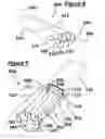 Fig. 05 - Composite blade root structure