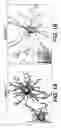 Fig. 02 - ACTIVIN RECEPTOR-LIKE KINASE-1 COMPOSITIONS AND METHODS OF USE