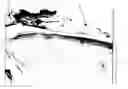 Fig. 01 - ADHESION INHIBITING MATERIAL FOR VERTEBRAL/SPINAL OPERATION