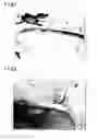 Fig. 02 - ADHESION INHIBITING MATERIAL FOR VERTEBRAL/SPINAL OPERATION