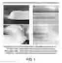 Fig. 02 - Compositions And Methods For Cardiovascular Surgery