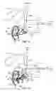 Fig. 07 - Anastomotic device