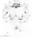 Fig. 01 - Anatomical recognition and dimensional analysis of breast volume to assist breast surgery