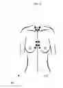 Fig. 06 - Anatomical recognition and dimensional analysis of breast volume to assist breast surgery