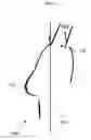 Fig. 07 - Anatomical recognition and dimensional analysis of breast volume to assist breast surgery