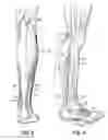 Fig. 04 - Muscle strength assessment system