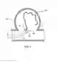 Fig. 02 - MULTIPLE BIOCOMPATIBLE POLYMERIC STRAND ANEURYSM EMBOLIZATION SYSTEM AND METHOD