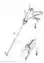 Fig. 03 - Endoscopic surgical clip applier