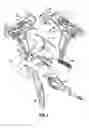 Fig. 13 - Endoscopic surgical clip applier