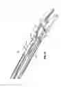 Fig. 25 - Endoscopic surgical clip applier