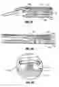 Fig. 55 - Endoscopic surgical clip applier