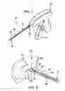 Fig. 02 - Arthroscopic meniscal repair systems and methods