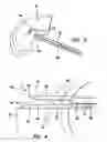 Fig. 03 - Arthroscopic meniscal repair systems and methods