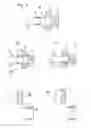 Fig. 02 - Intervertebral stabilization system