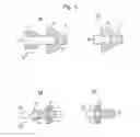 Fig. 07 - Intervertebral stabilization system