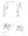 Fig. 10 - Intervertebral stabilization system