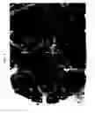 Fig. 02 - Extracellular novel RAGE binding protein ( EN-RAGE) and uses thereof