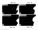 Fig. 22 - Extracellular novel RAGE binding protein ( EN-RAGE) and uses thereof