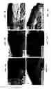 Fig. 23 - Extracellular novel RAGE binding protein ( EN-RAGE) and uses thereof